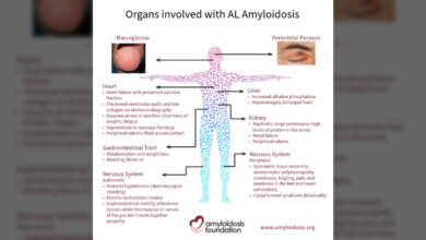 NFL star Art Still raises awareness on amyloidosis